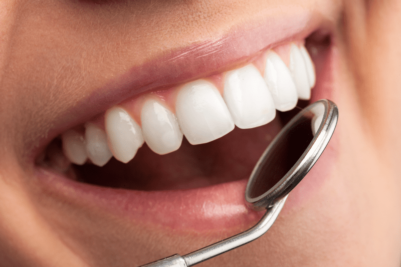 La importancia de acudir al dentista