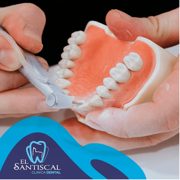 ¿Cómo se hacen las prótesis dentales?