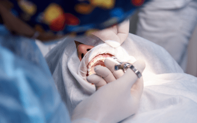 Descubre la guía completa para la recuperación y cuidado después de una cirugía de encías.