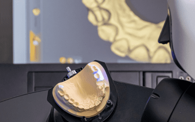 La tecnología CAD/CAM en la odontología.